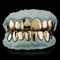Custom Gold Grillz- Top