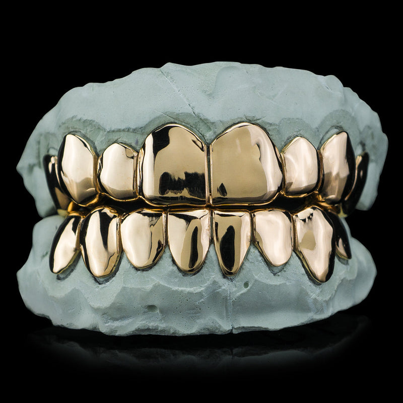 Custom Gold Grillz- Top